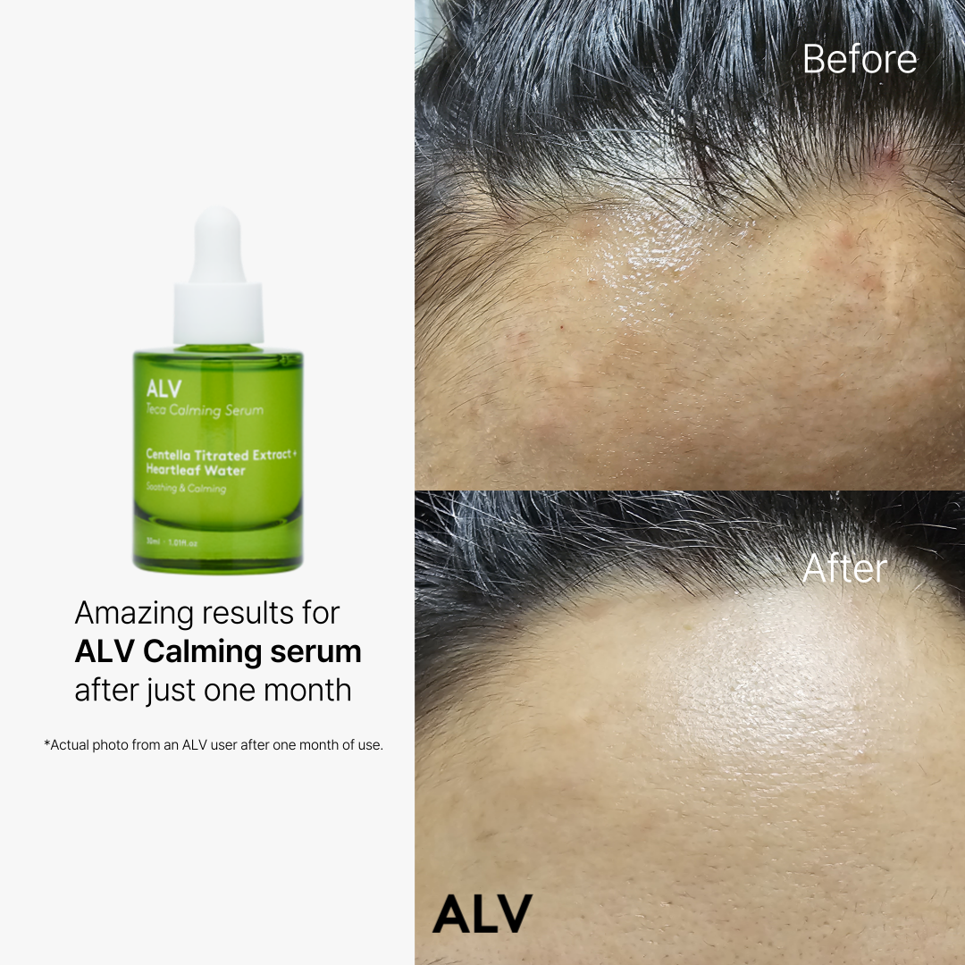 ALV Advanced Centella Soothing Serum – Calming & Hydrating for Sensitive Skin (30ml / 1 fl.oz)